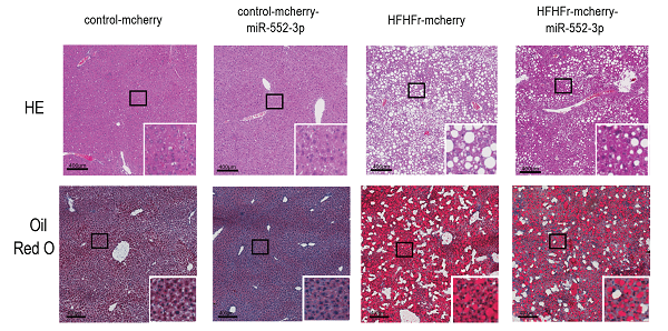 miR-552-3p对肝内糖脂代谢的调控作用
