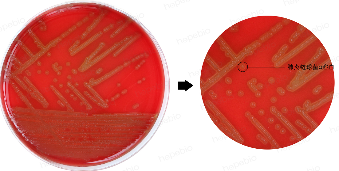 细菌溶血试验原理及现象(青岛海博生物原创)