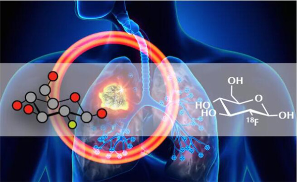 看这篇就够了—葡萄糖摄取分析
