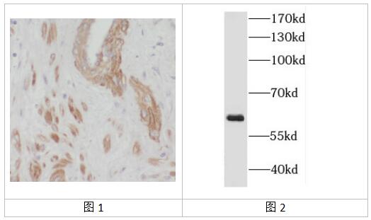 Mybiosource抗 DGKE 抗体丨Mybiosource DGKE兔多克隆抗体 Mybiosource抗 DGKE 抗体丨Mybiosource DGKE兔多克隆抗体
