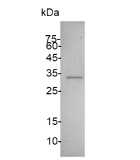 中英文说明丨艾美捷Recombinant Der p 1 protein说明书 中英文说明丨艾美捷Recombinant Der p 1 protein说明书