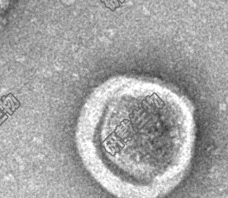 外泌体透射电镜.png 外泌体透射电镜.png