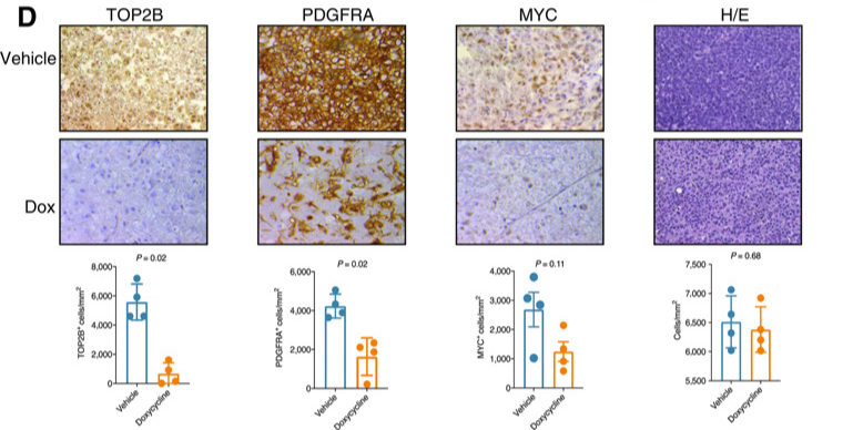 Clin Cancer Res: 拓扑异构酶TOP2B对调节人类神经胶质瘤生长的新型表观遗传学机制