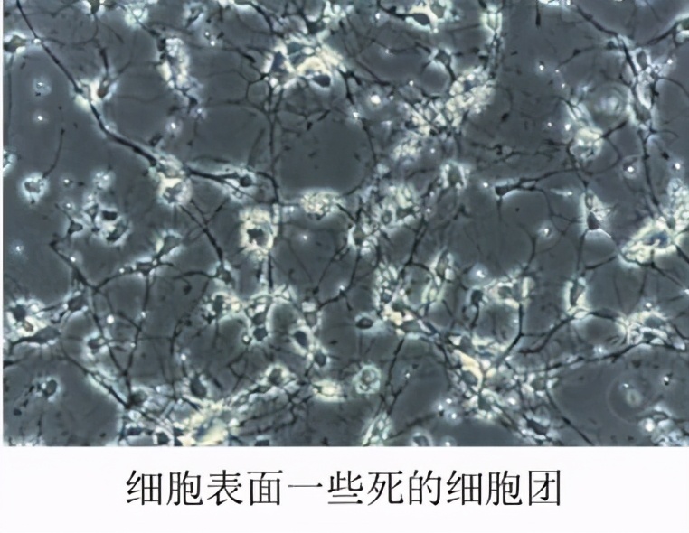 为什么细胞养不好？你知道哪些养细胞的技巧？