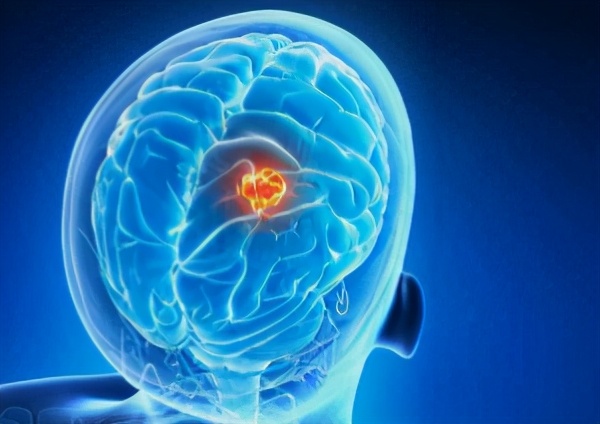 实验室生长的杀伤细胞（fcs）可以治疗脑肿瘤