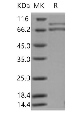 Assay Genie重组人XRCC5和 XRCC6 异二聚体蛋白(RPES2837)