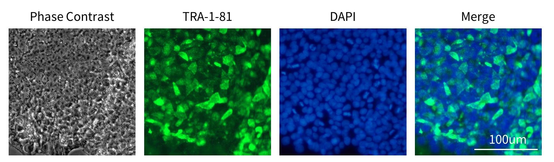 12种多能干细胞荧光检测试剂盒来了