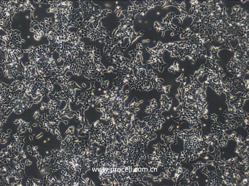 细胞学堂 | 从传代到换液，养好 22RV1