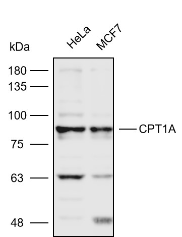 抗体产品星推荐第十八期|Anti-CPT1A Polyclonal Antibody