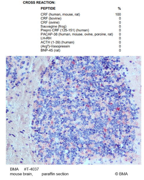 BMA纯抗血清多克隆抗体正在促销中