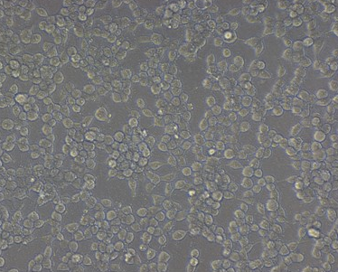 细胞转染实验失败了，怎么解救？