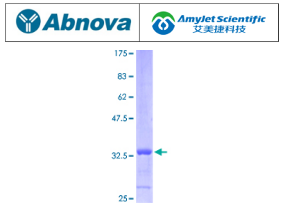 Abnova 艾美捷C3（小鼠）重组蛋白说明书