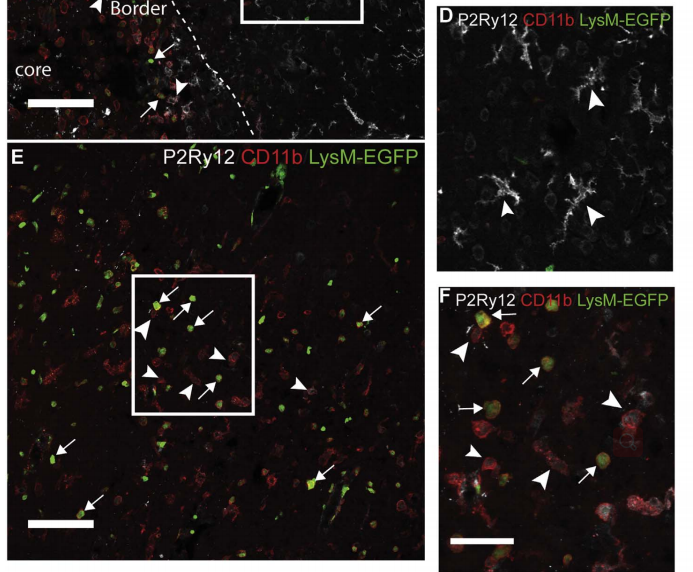 巨噬细胞上线，贴心呵护您的每一天