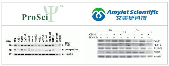 艾美捷ProSci丨ProSci 凋亡抑制蛋白检测套装解决方案 艾美捷ProSci丨ProSci 凋亡抑制蛋白检测套装解决方案
