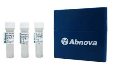 HIV-1 p24 ELISA试剂盒操作注意事项 HIV-1 p24 ELISA试剂盒操作注意事项