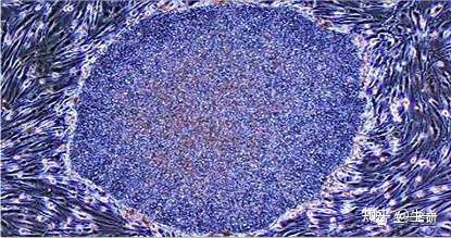 IPS诱导多能行干细胞的介绍