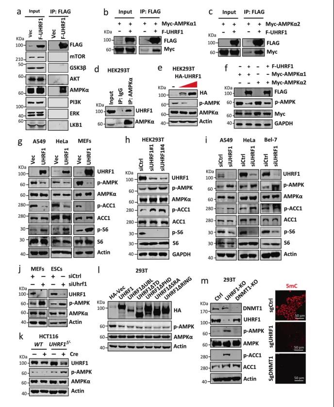UHRF1调控糖脂代谢