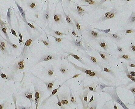 细胞生长因子的重要性有何体现