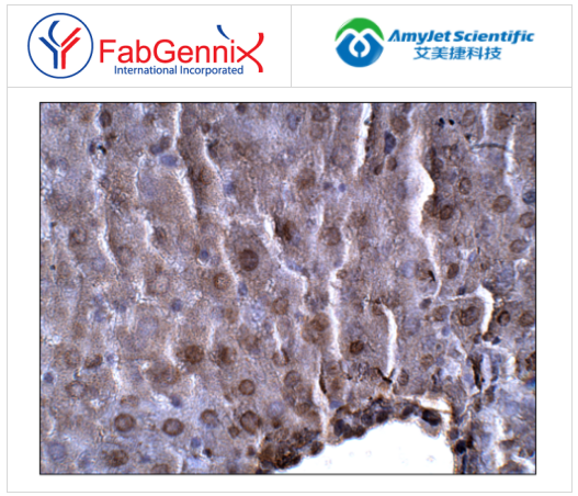 FabGennix-脂联素抗体促销啦 FabGennix-脂联素抗体促销啦