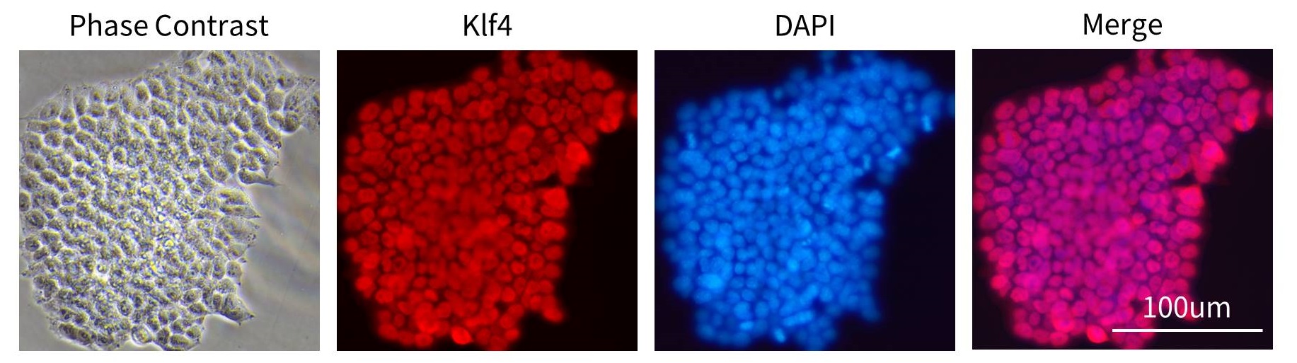 12种多能干细胞荧光检测试剂盒来了