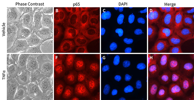 NF-κB激活-核转运检测试剂盒上新啦！