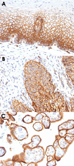 艾美捷THBD单克隆抗体免疫组化应用和其它研究 艾美捷THBD单克隆抗体免疫组化应用和其它研究