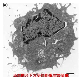 细胞坏死——细胞死亡研究新热点
