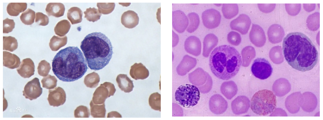 外周血单个核细胞攻略