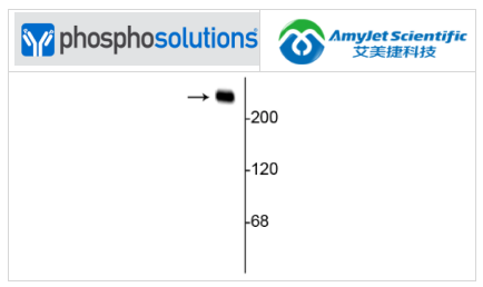 艾美捷Phosphosolutions抗αII光谱蛋白抗体(3D7)方案 艾美捷Phosphosolutions抗αII光谱蛋白抗体(3D7)方案