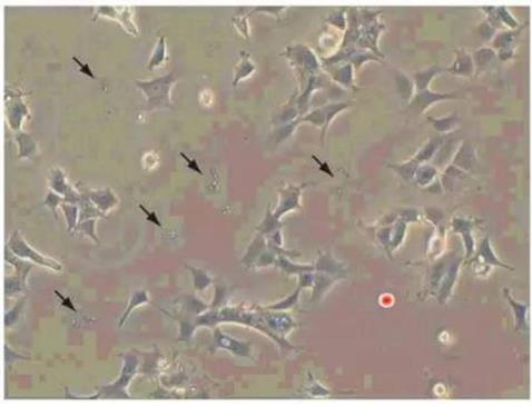 细胞被支原体污染怎么办，耶稣都救不了的爱必信来救