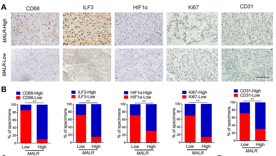 【客户文献解读,IF>11】食管癌的