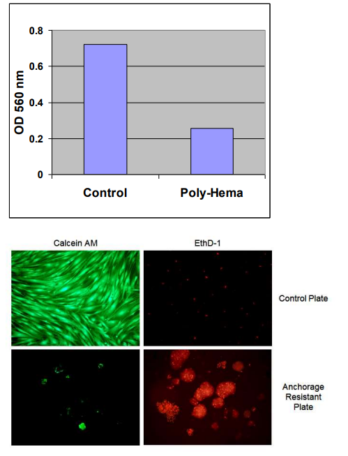 艾美捷细胞失巢凋亡检测试剂盒测定原理&化验方案 艾美捷细胞失巢凋亡检测试剂盒测定原理&化验方案