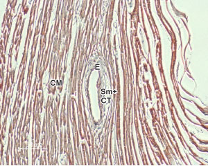 钠钙交换体（Na+/Ca2+ Exchangers，NCX）的简介及研究工具