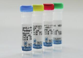 Nature, Cell都在用的Relia Tech 抗原亲和纯化LYVE1抗体 Nature, Cell都在用的Relia Tech 抗原亲和纯化LYVE1抗体