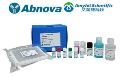 艾美捷Abnova多肽设计和合成解决方案 艾美捷Abnova多肽设计和合成解决方案