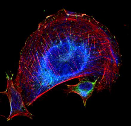 Jackson多克隆抗体丨艾美捷Jackson纳米二级抗体研究