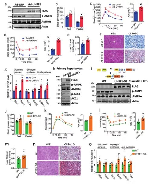 UHRF1调控糖脂代谢