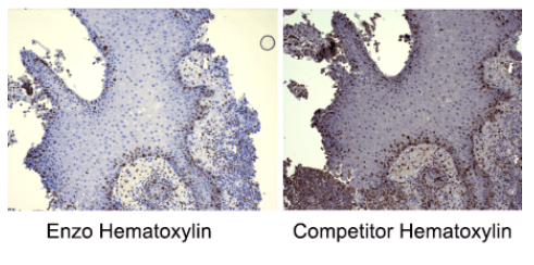 Enzo丨Enzo HIGHDEF苏木丨精解决方案