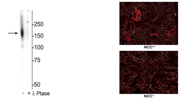 Phosphosolutions--抗NCC(噻嗪敏感NaCl共转运体)(Thr53)抗体促销啦 Phosphosolutions--抗NCC(噻嗪敏感NaCl共转运体)(Thr53)抗体促销啦