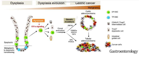 Gastroenterology：科学家揭示胃癌发生的新型分子机制