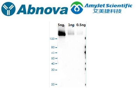艾美捷Abnova丨CRISPR SpCas9 多克隆抗体方案