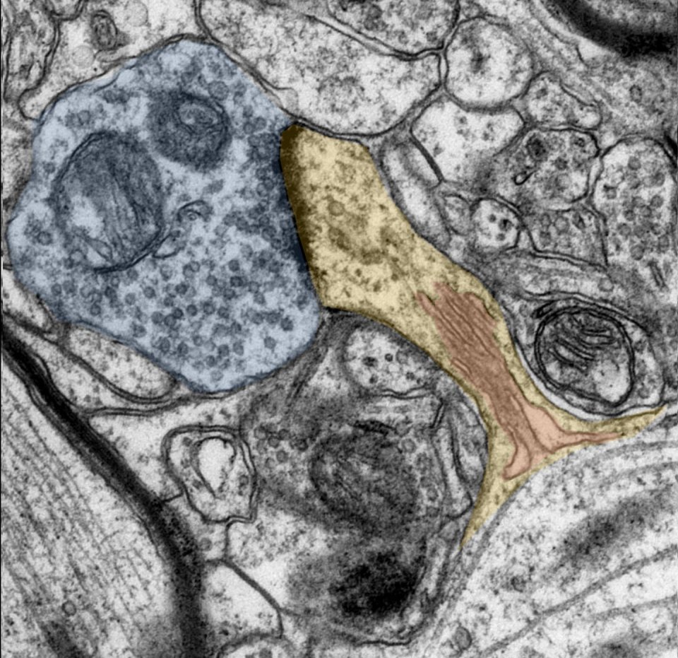 维生素A可以用于神经细胞，胎牛血清助力细胞研究