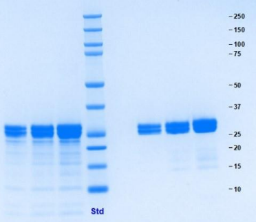 Athens-组织蛋白酶G，人中性粒细胞，天然蛋白促销，科研好物低价购