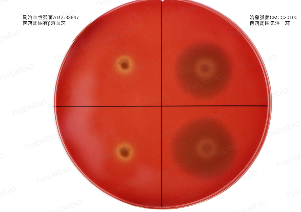 细菌溶血试验原理及现象(青岛海博生物原创) - 企业动态 - 丁香通