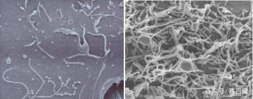 细胞出现支原体污染产生的影响和清除服务有哪些？
