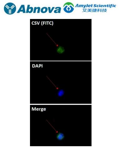 Abnova丨艾美捷CSV 单克隆抗体解决方案 Abnova丨艾美捷CSV 单克隆抗体解决方案