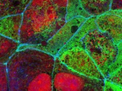 研究成功绘制出人类癌细胞系的转移图谱