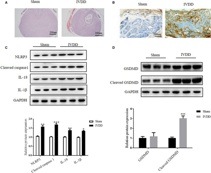 间充质干细胞衍生的外泌体通过抑制焦亡来改善椎间盘退变