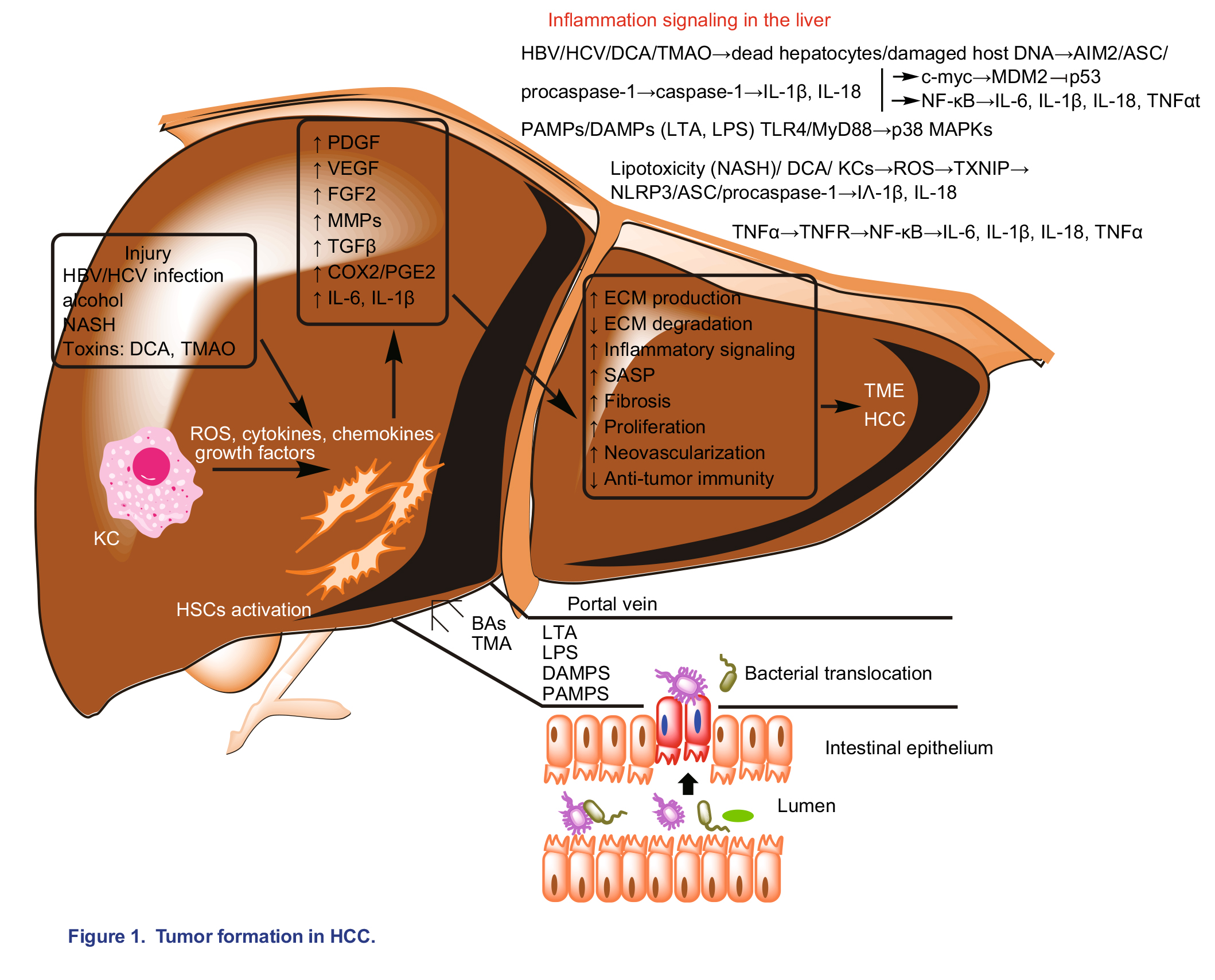 新发现：结直肠癌和肝细胞癌的肠道菌群差异
