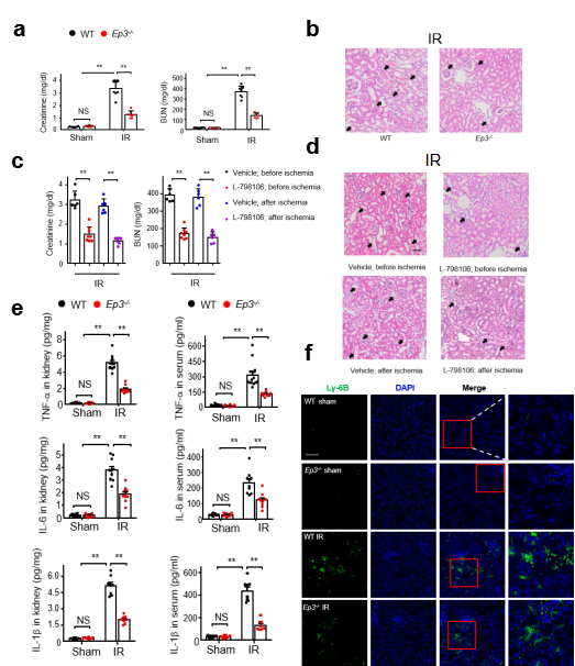 急性肾损伤发病机制